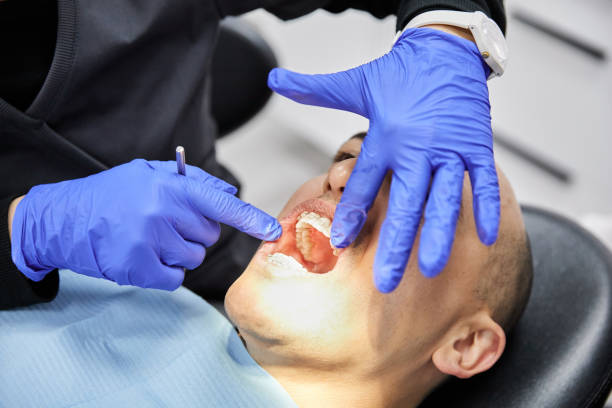 Best Broken Tooth Emergency  in Mount Plymouth, FL